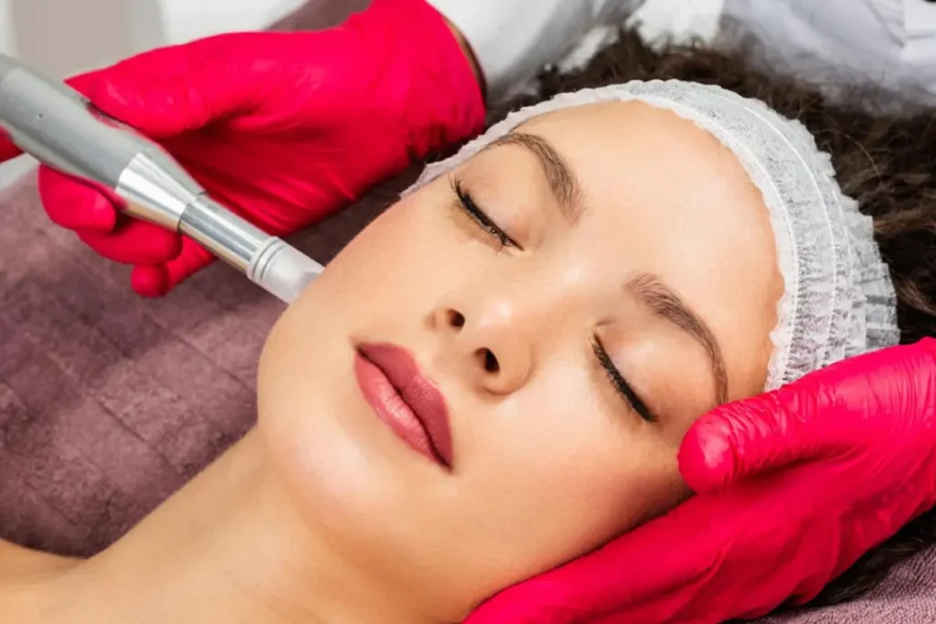 Woman receiving a microneedling treatment at a dermatologist's office, focusing on skin rejuvenation and improving texture.