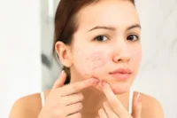 A teen girl squeezing a pimple on her face indoors, dealing with acne as part of her skincare routine.